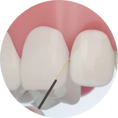 歯周病治療 PERIODONTAL