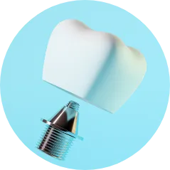 セラミック治療 CERAMIC