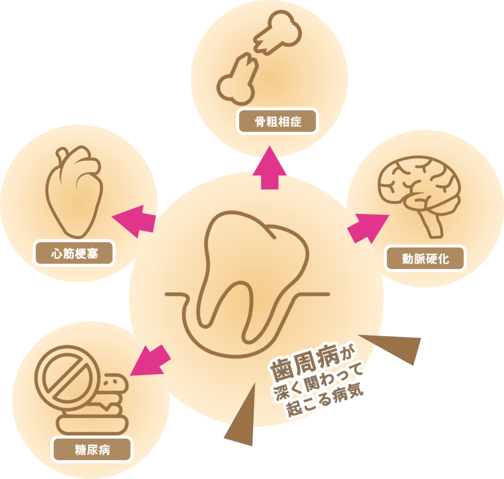 全身疾患と歯周病の関係性