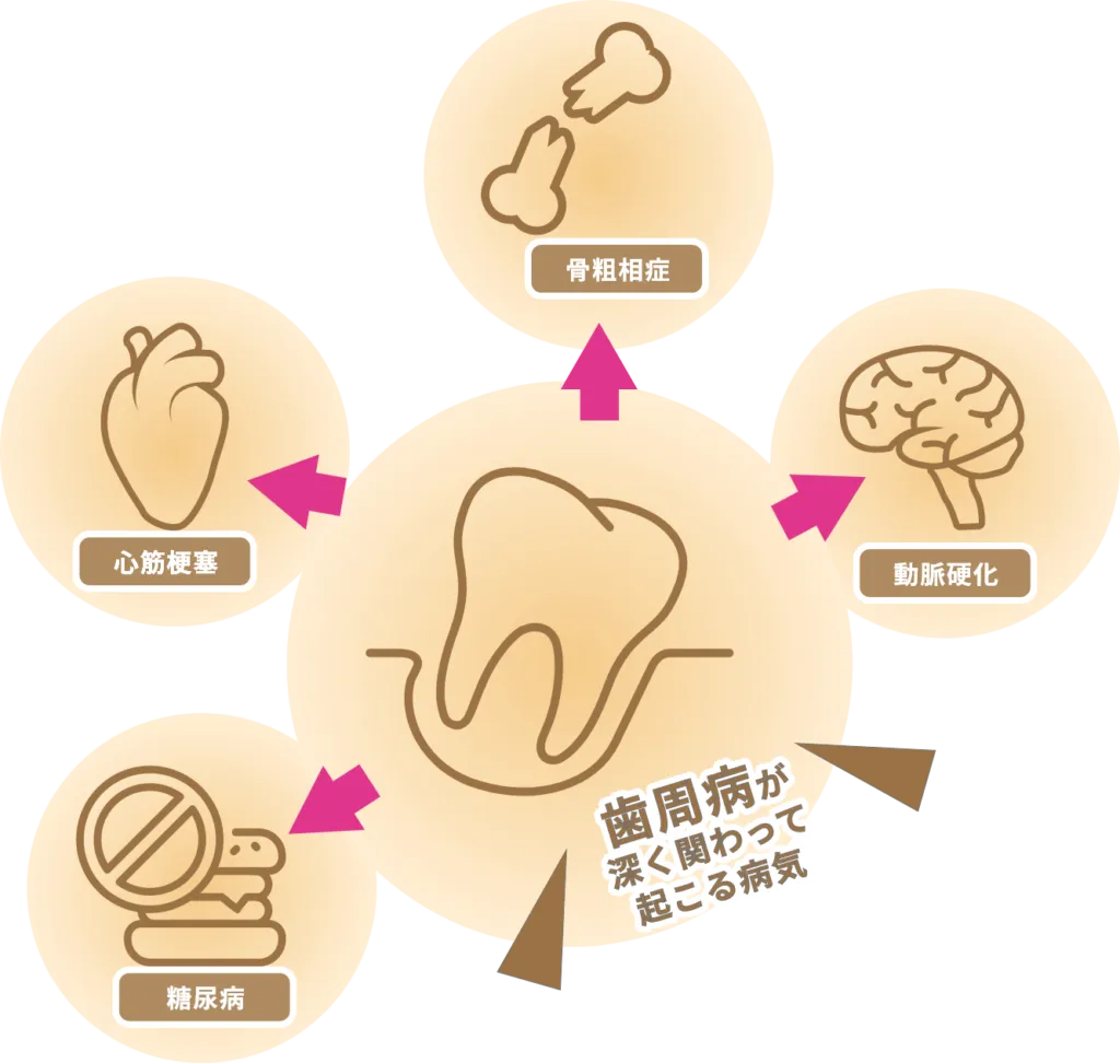 全身疾患と歯周病の関係性